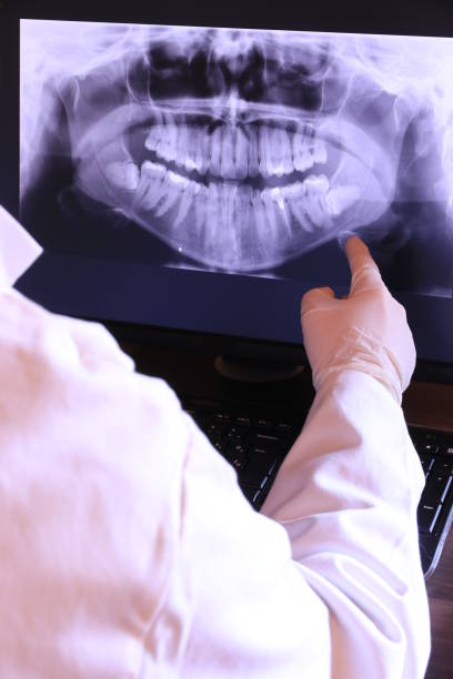 Best Emergency Treatment for Oral Infections in South Rosemary, NC