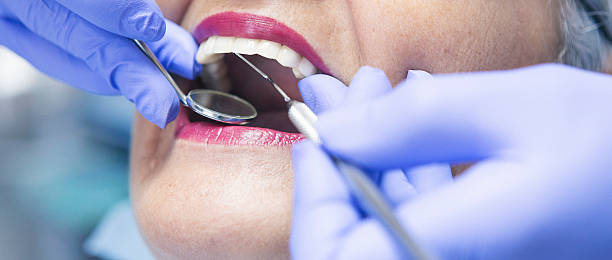 Best Dental Abscess Treatment in South Rosemary, NC