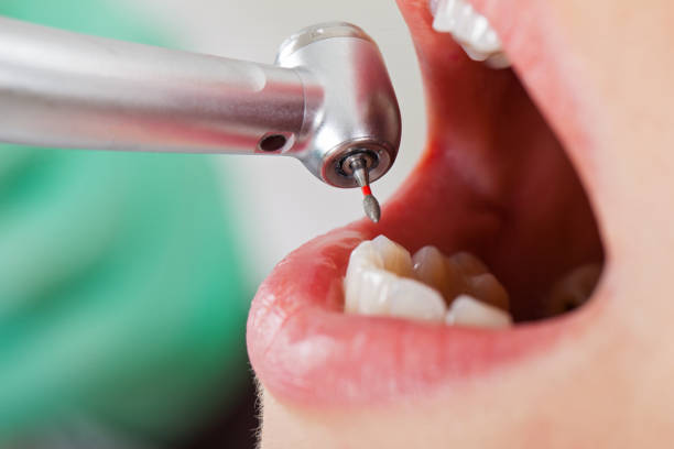 Best Emergency Denture Repair in South Rosemary, NC